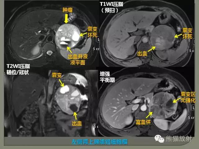 如何简单理解、认识MRI图像