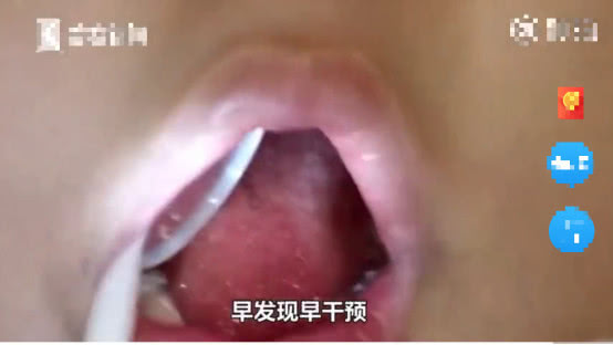 5岁男童张嘴睡觉用嘴呼吸正常吗,小孩反复张嘴闭嘴