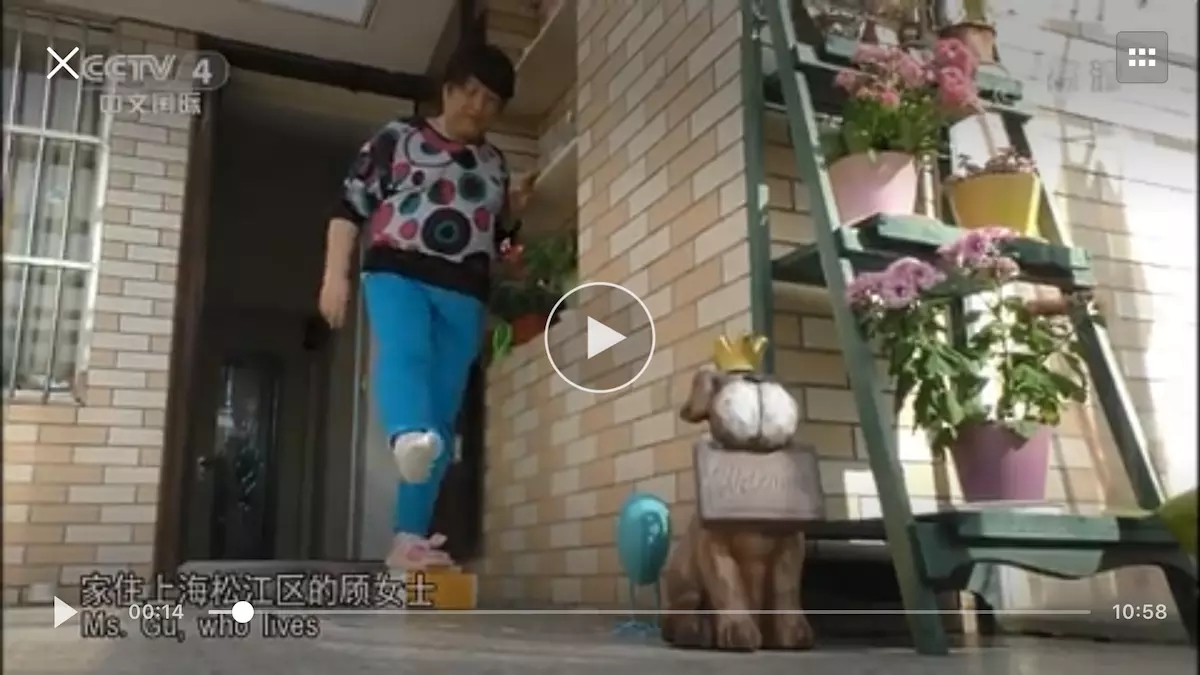 膝关节炎问诊,骨科医生谈膝关节