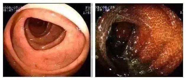 比贩毒还暴利的十个行业,比贩毒还暴利的小本生意