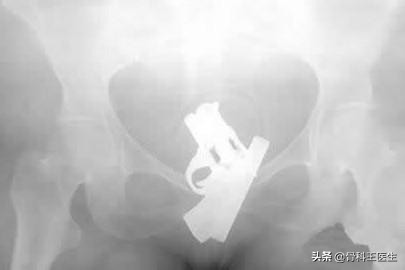 为什么会有人塞异物到直肠里,为什么会有人往尿道里塞异物