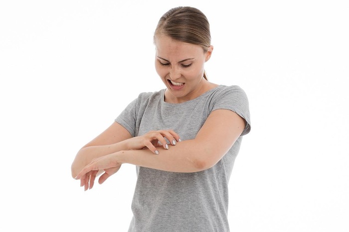 挠荨麻疹,荨麻疹尽量别挠