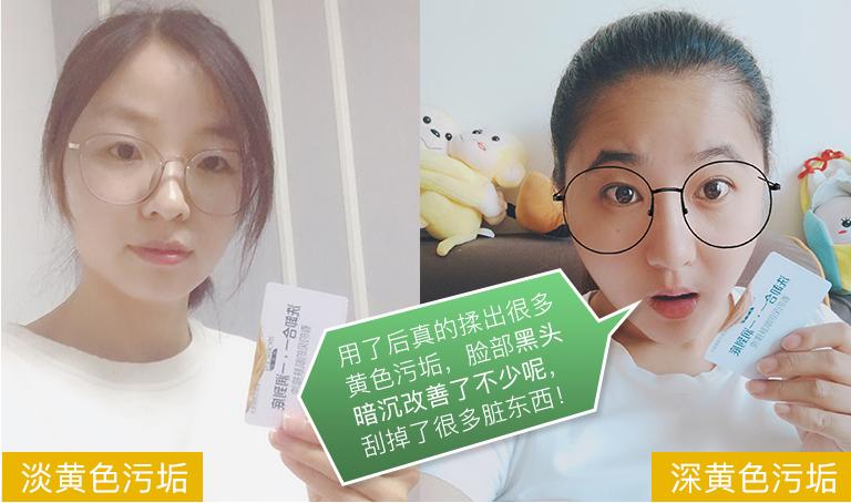 黑头疯长,口罩一摘吓死人?用它揉一揉,毛孔垃圾全吸走