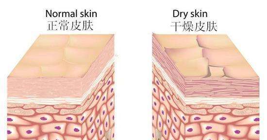 白富美就得靠补水!只知道敷面膜可不一定能得到好的效果