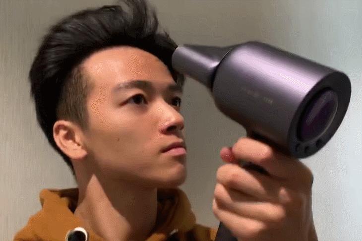 贝克汉姆怎么治疗脱发,贝克汉姆脱发的原因