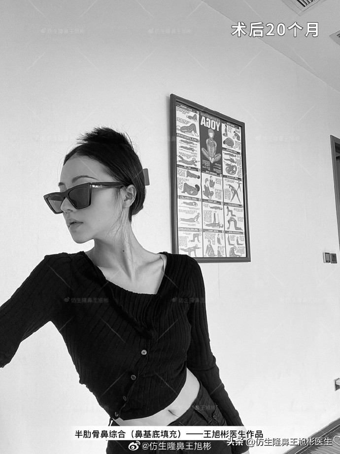 被鼻子封印的颜值,那些被鼻子封印的颜值