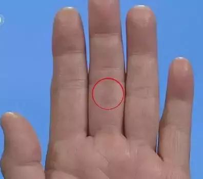 手的健康识别,看手识病疾病自测