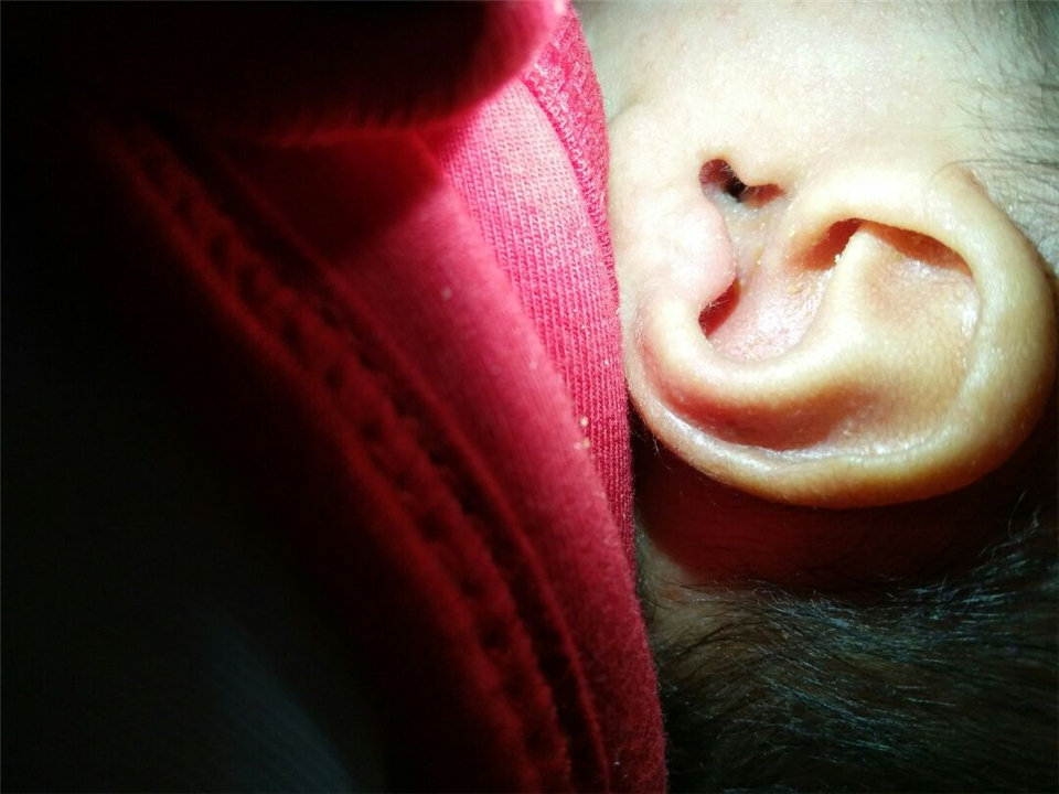 4岁孩子耳朵进了“小蜘蛛”90后妈妈的急救方式，堪称教科书一般