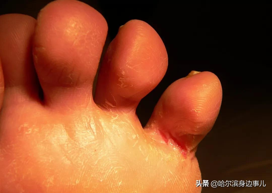 女生说袜子和内裤不能一起洗,夫妻袜子内裤一起洗行吗