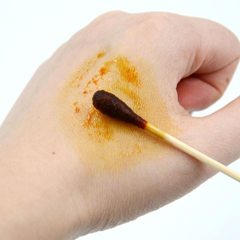 被猫跟狗咬了会得狂犬病吗,被猫跟狗咬了打的是同一款疫苗吗