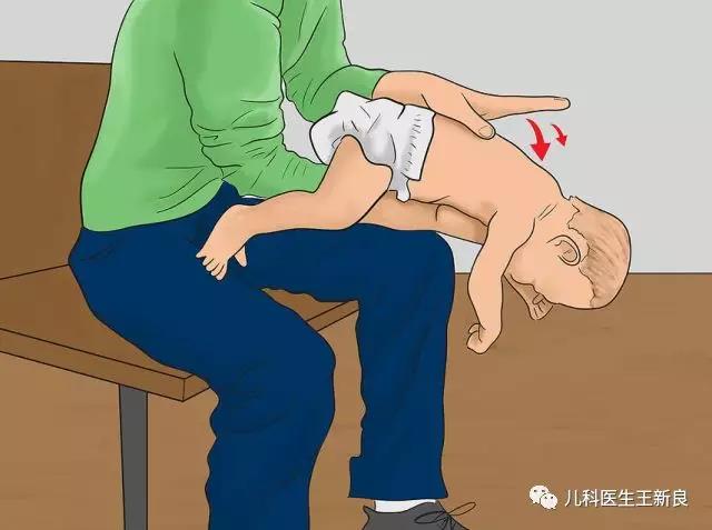 异物卡喉快用海姆立克法抢救,异物卡喉海姆立克急救方法