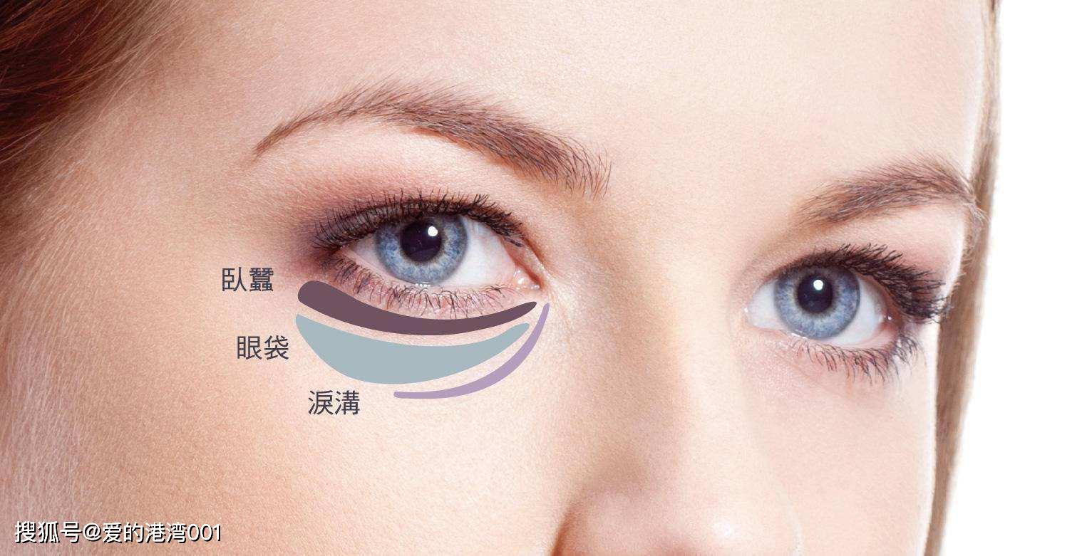 眼袋发青怎么祛除眼袋,怎样去除眼袋最好最有效的方法