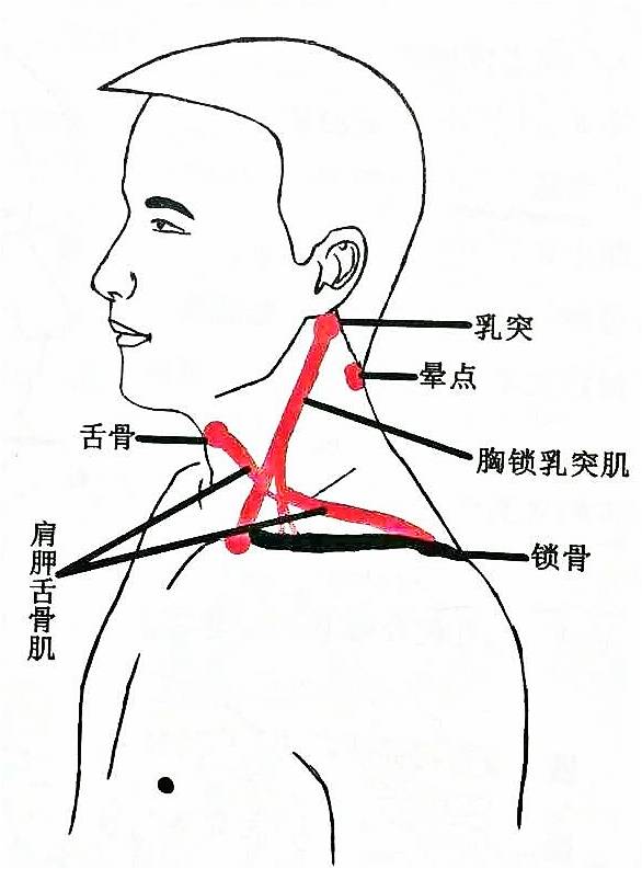 感冒失音,感冒失音怎么办