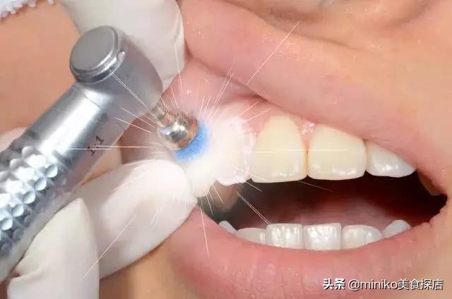 祛痘、脱毛、洗牙？点开这篇文章，离女神更近一步