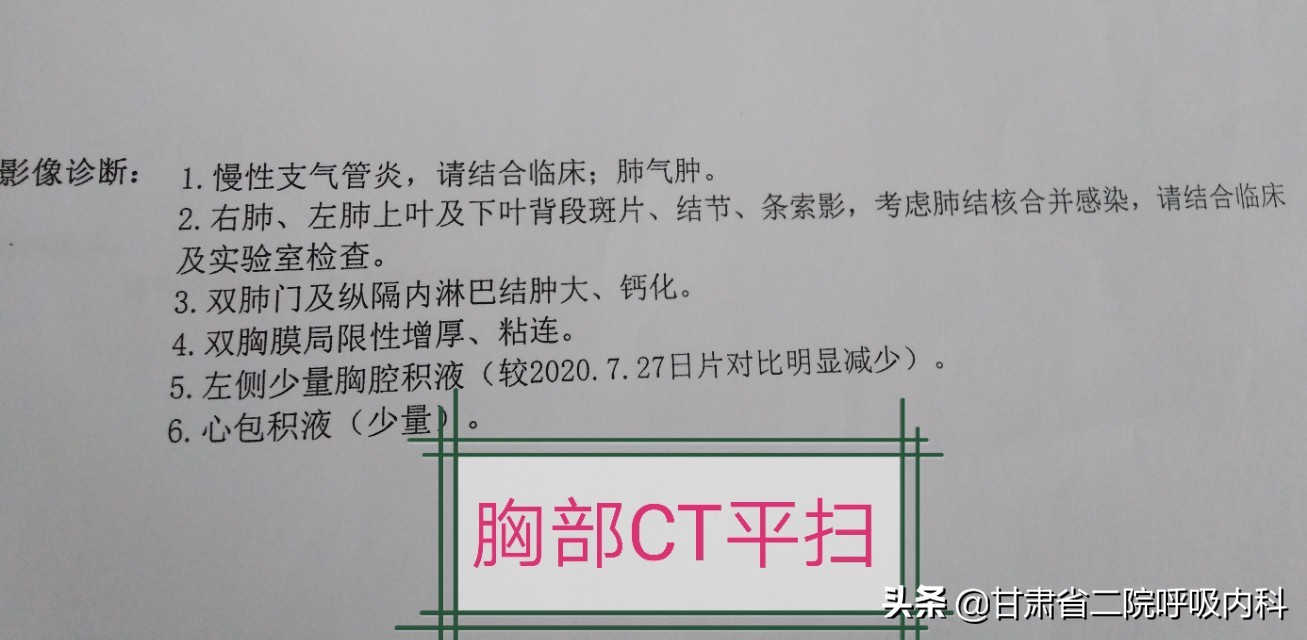 老人咳嗽胸腔积液怎么消除和恢复,老年人反复胸腔积液怎么回事