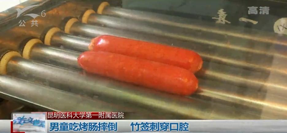 一根烤肠险些要了这个宝宝的命！8厘米竹签从口腔刺破咽喉，尖端险些刺入生命中枢