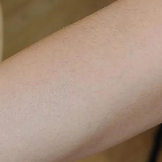 又到了穿小裙的季节，鸡皮女孩该怎么办……