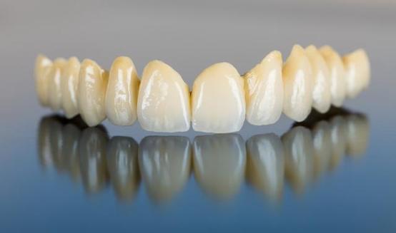 二氧化锆全瓷牙有辐射吗,氧化锆全瓷牙一颗多少钱