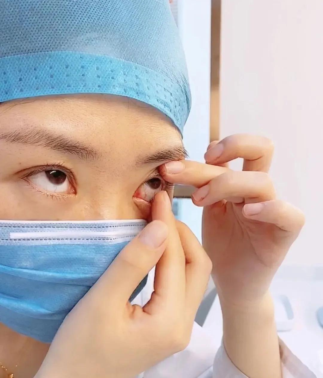 隐形眼镜怎么摘新手一次成功,隐形眼镜怎么摘都摘不下有影响吗