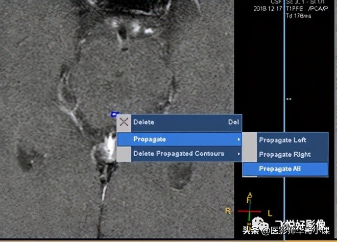 飞利浦磁共振快速扫描方案指南,飞利浦1.5t磁共振各部位扫描技术