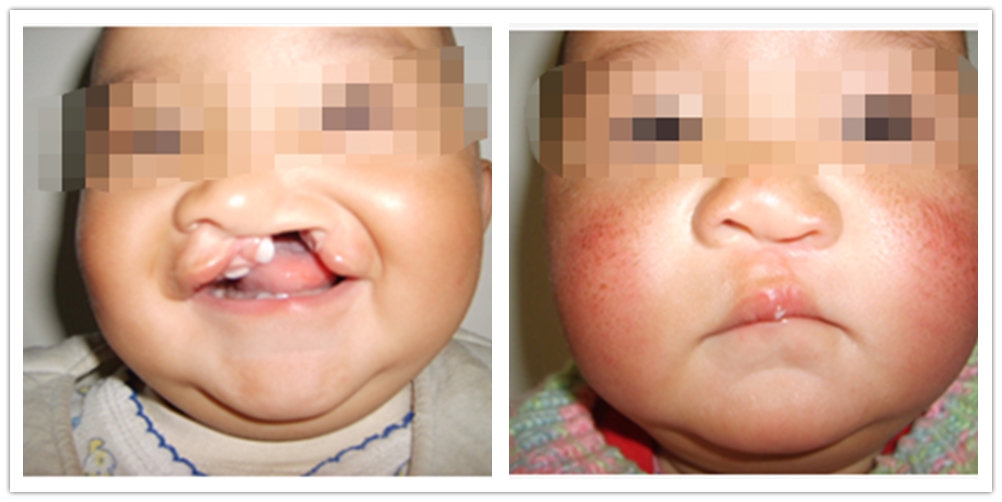 口腔科诊疗指南及技术操作常规,口腔科疾病的最新诊疗护理措施