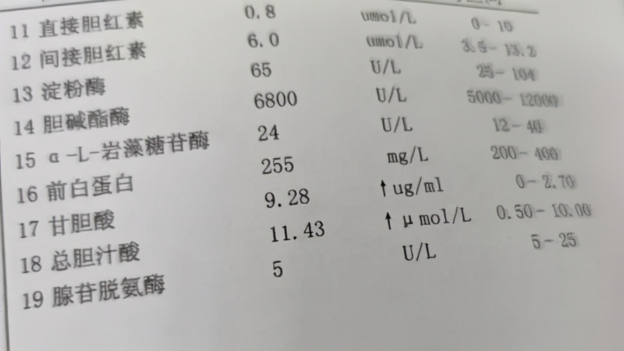甘胆酸检查能查胆汁淤积吗,甘胆酸纳入肝功测试