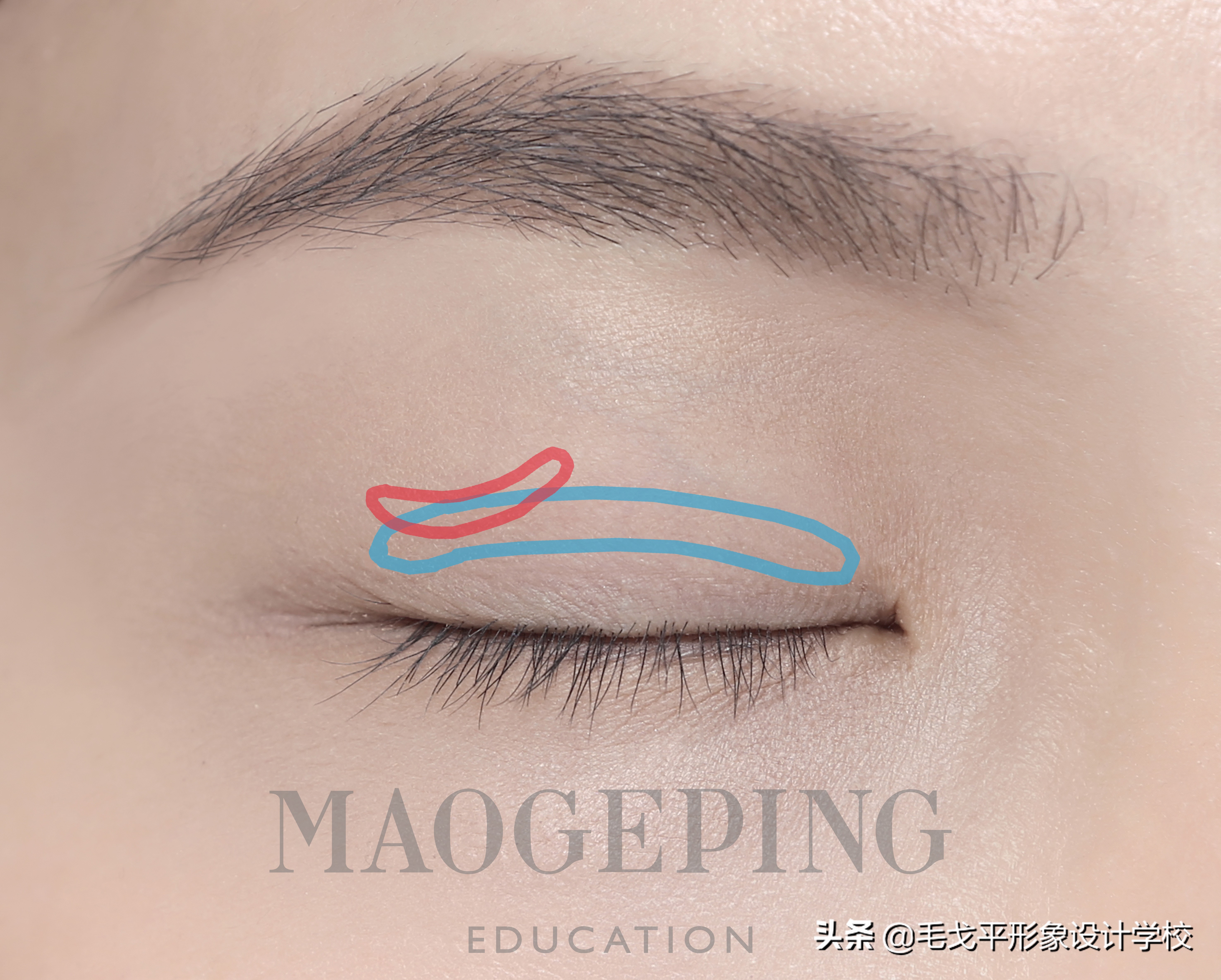 单眼皮肿眼泡正确贴法教程,单眼皮肿眼泡怎么贴双眼皮