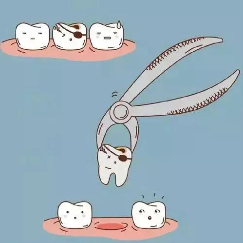 牙齿矫正疼痛有多厉害,牙齿矫正疼得厉害怎么回事