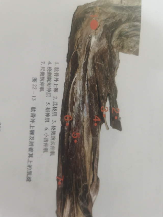 手肘忽然酸痛怎么缓解,手肘酸痛怎么办最快解决方法