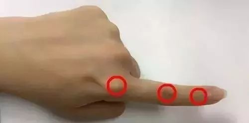 按手指哪个部位可治失眠,刮十指治便秘