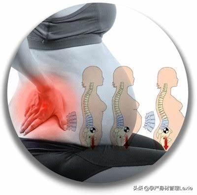 孕晚期纠正骨盆前倾最佳方法,孕妇骨盆前倾训练动作