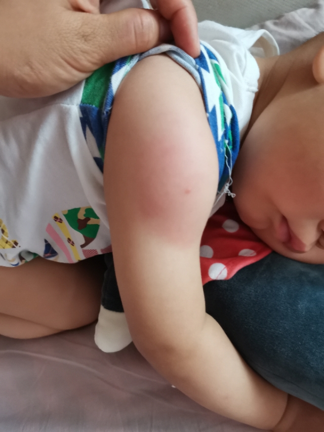 小孩打预防针后发烧抽搐吐白沫,宝宝打了预防针后出现抽搐