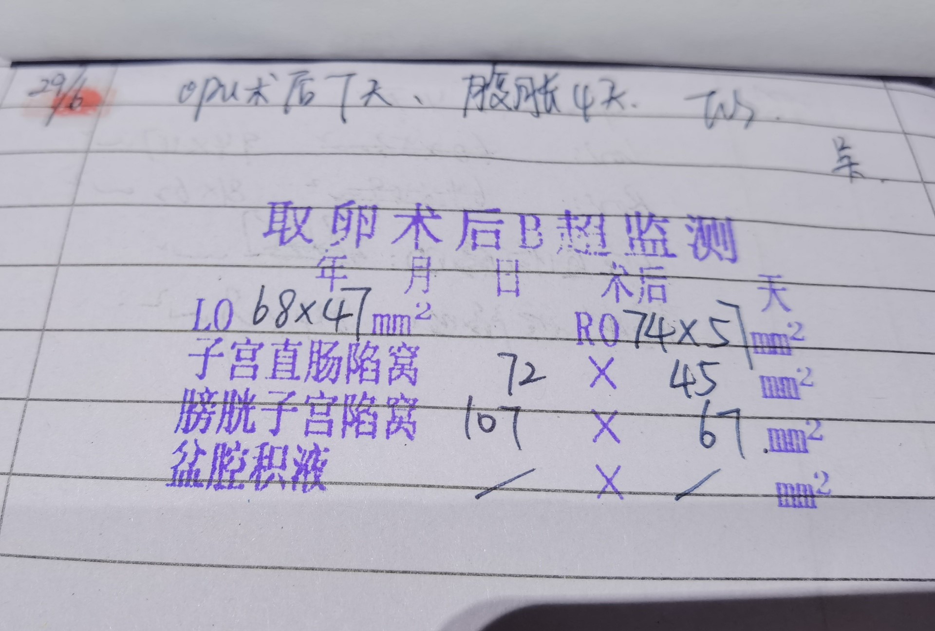 肚子里像有水一样咕噜噜的,肚子里都是水会感觉饿吗