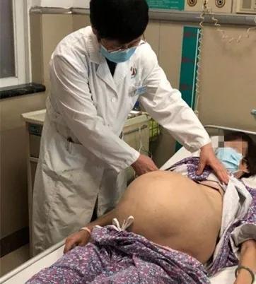 60岁长个15厘米的子宫肌瘤,子宫肌瘤55