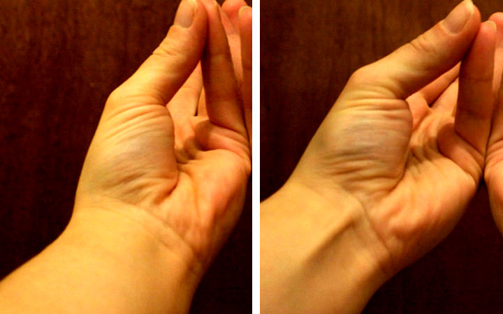 25%的人手臂中都会缺少一块肌肉：看看你也是这样吗？