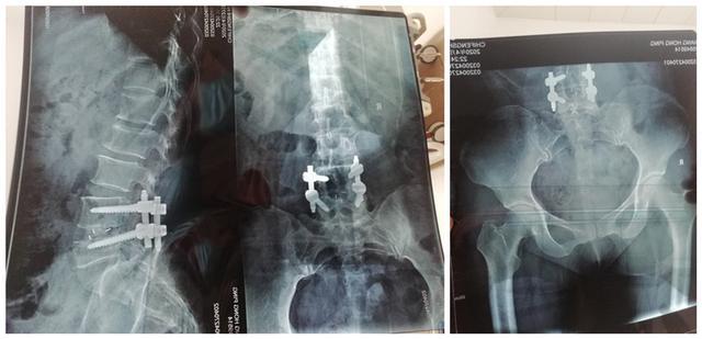 姐夫把小舅子车撞了一下怎么办,小姨子开车撞姐夫保险赔吗