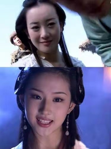 张檬取出假体颜值重回巅峰,张檬取出假体颜值重回巅峰照片