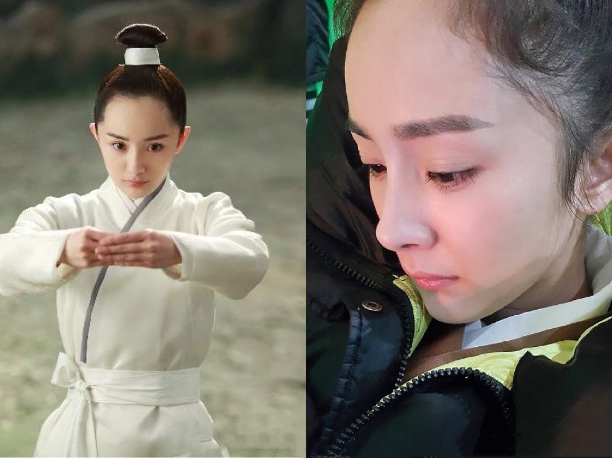 发际线成颜值杀手？杨幂宋茜都扛不住要植发，程潇王鸥却轻松挽救