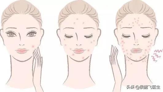 地塞米松护理口诀,侯医生讲座视频