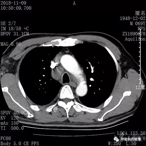 怎么应用统计学做调查,统计学方法可以解决的主要问题