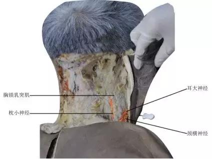 颈源性头痛中医治疗,颈源性头痛中药处方