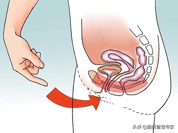 产后会尿失禁吗,产后尿失禁普遍吗