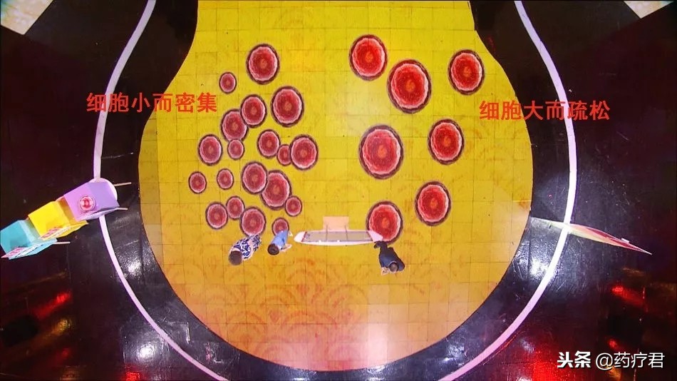 不想痛风发作5种饮料一定要戒掉,不想痛风吃什么食物最好