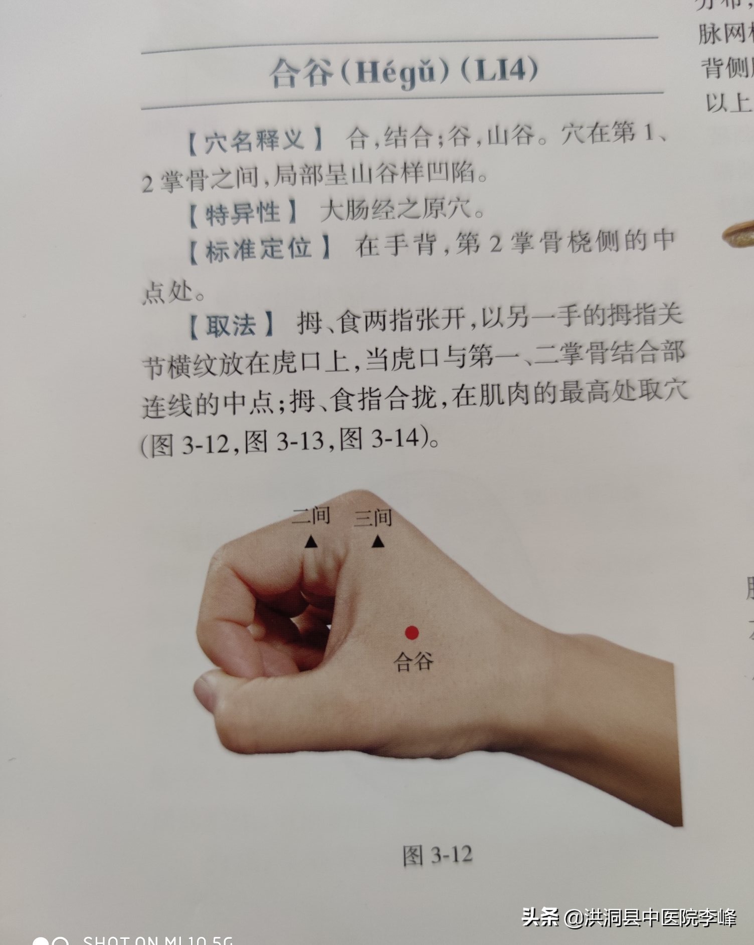 常见痛症“针刺运动疗法”特定取穴