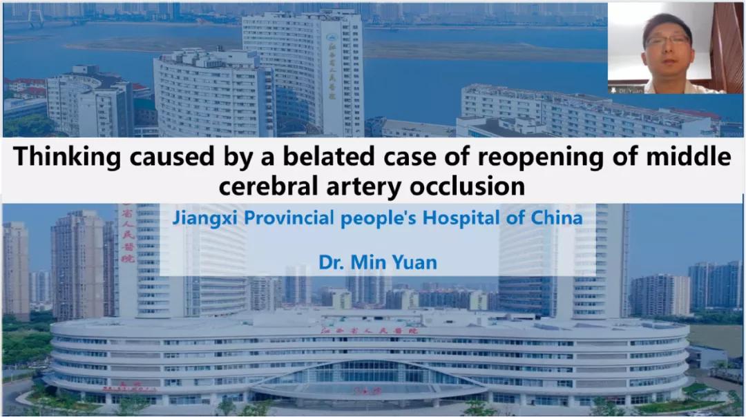 参加乔治·华盛顿大学医院神经内科远程研修项目体会