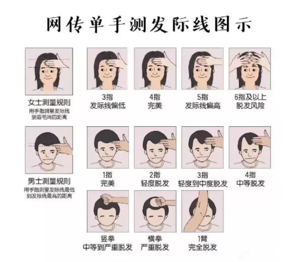 张柏芝早期发际线形状,张柏芝完美发际线