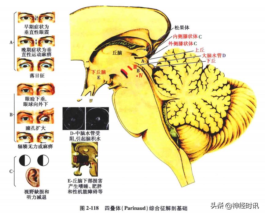 脑干解剖,脑干神经解剖