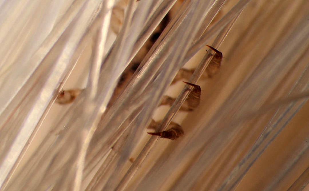 虱子和阴虱样子一样吗,阴虱头虱体虱能用一样的药吗