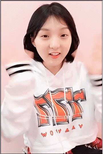 阿娇大龅牙,阿娇整牙