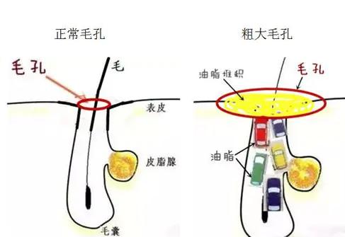 俏肌杭润怎么样,俏肌杭润的产品
